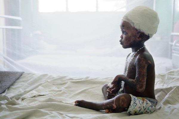 Abalo Joyce, Lacor Hospital, Gulu Uganda, Heather McClintock, 2006